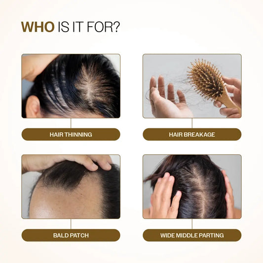 Hair Growth Serum (30 ml | Pack of 3) & Scalp Massager Hair Growth Combo